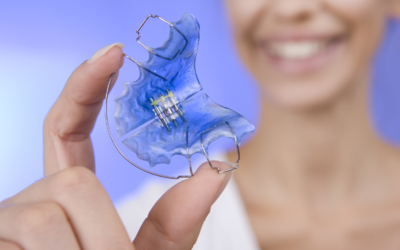 After Braces Comes Retainer