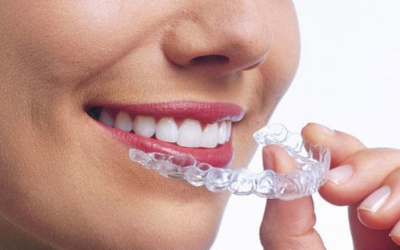 Invisalign Popular in Franklin Lakes
