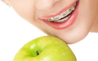 Avoid Damaging Braces while Apple Picking