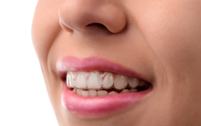 Keep Your Invisalign Clean in Berkley Heights
