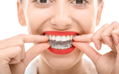 How to Ensure You Are Getting the Best Invisalign Treatment