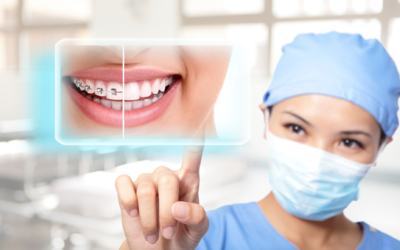 Which is Better: Invisalign for Adults or Adult Braces?
