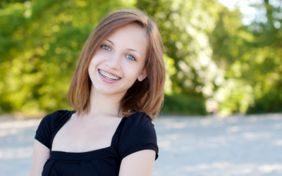 Tips for Choosing a Braces Provider