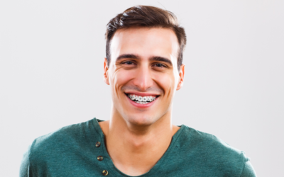 How Old is Too Old for Braces?
