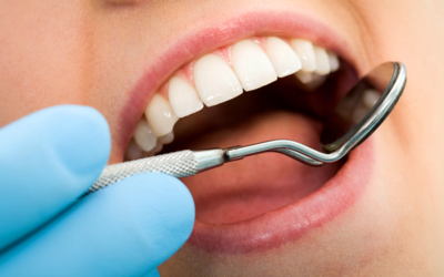 How Is an Orthodontist Different from a Dentist?