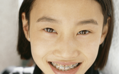 Braces New Providence NJ