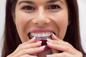 Cost of Invisalign Without Insurance