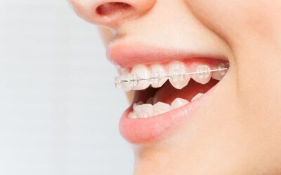 Top Rated Orthodontist Near Me