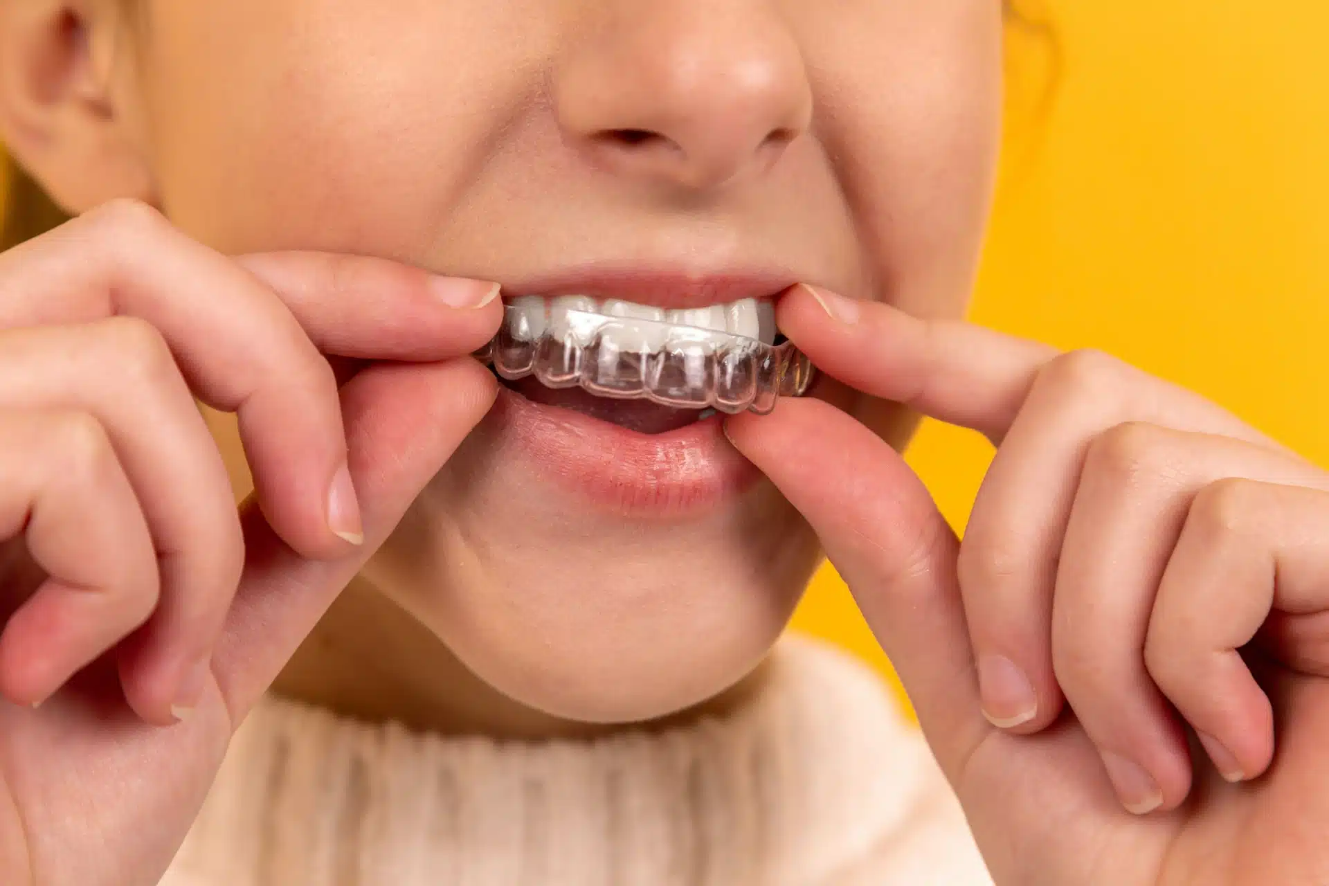 Invisalign in Warren NJ