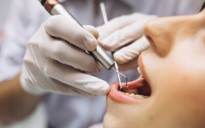 The Causes of Crooked Teeth and How Orthodontics Can Help
