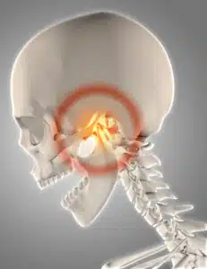 Treatment for TMJ disorders