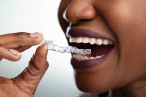 will Invisalign help TMJ