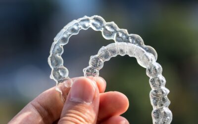Types of Retainers Offered at Smiles by Lorino