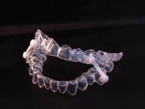 Oral appliance for sleep apnea treatment