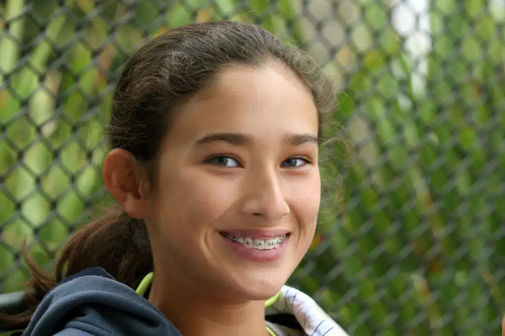 Girl smiling with braces, illustrating how long braces are worn
